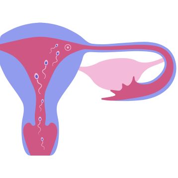 IUI (Intrauterine Insemination) icon